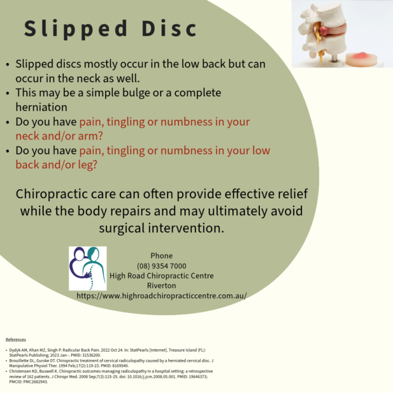 Slipped Disc – High Road Chiropractic Centre